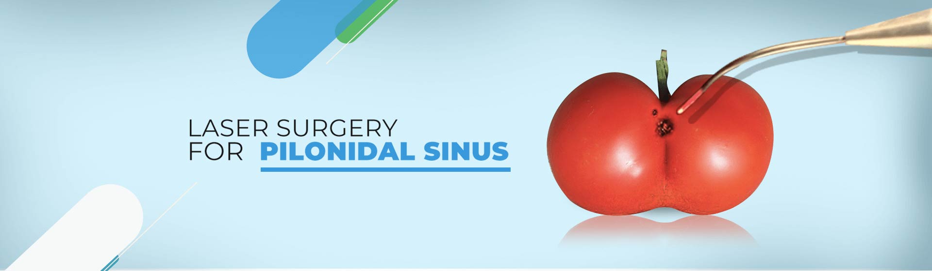 pilonidal sinus doctor