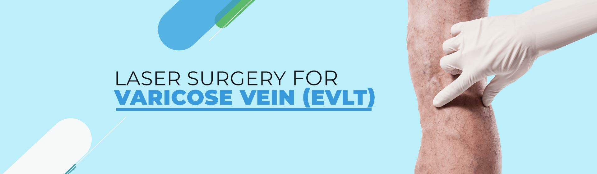 varicose veins surgeon in kolkata