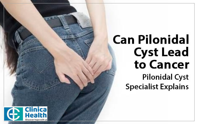 Pilonidal Cyst, Tailbone Cyst