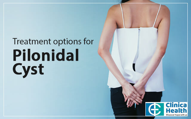 Treatment options for Pilonidal Cyst