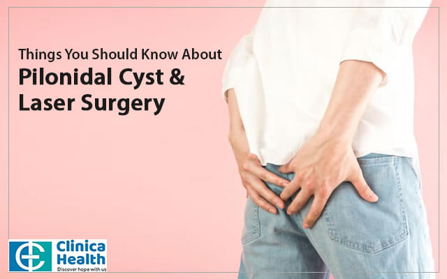 Things You Should Know About Pilonidal Cyst & Laser Surgery
