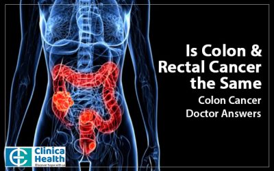 Is Colon & Rectal Cancer the Same: Colon Cancer Doctor Answers