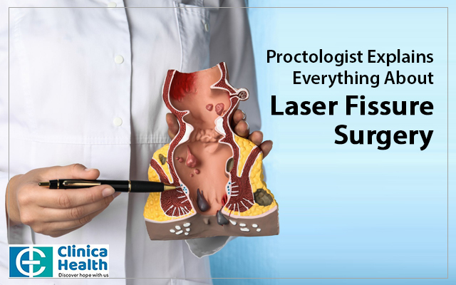 fissure laser surgery