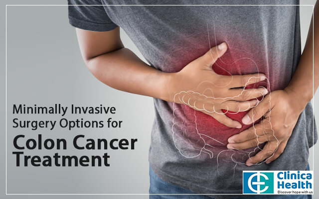 Minimally Invasive Surgery Options for Colon Cancer Treatment