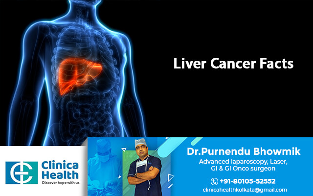 Liver Cancer Facts – Explained by a Specialist in Kolkata