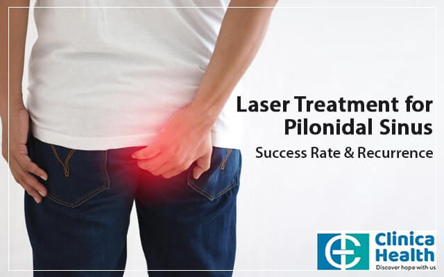 Laser Treatment for Pilonidal Sinus – Success Rate & Recurrence