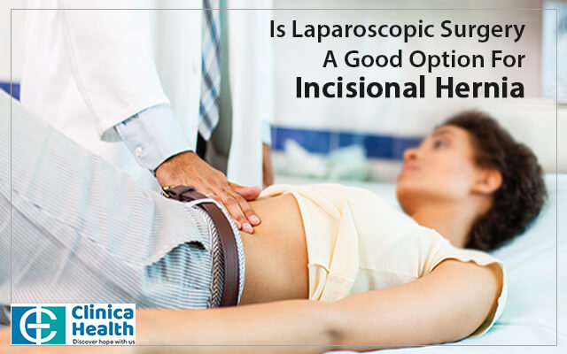 Is Laparoscopic Surgery A Good Option For Incisional Hernia