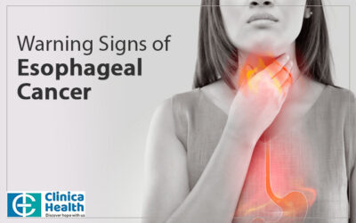 Cancer Doctor Explains Warning Signs of Esophageal Cancer