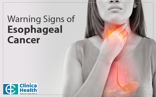 esophageal cancer surgery