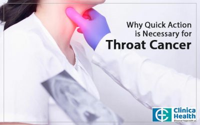 Why Quick Action is Necessary for Esophageal Cancer