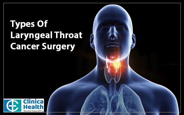 Types Of Laryngeal Throat Cancer Surgery