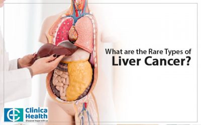 What are the Rare Types of Liver Cancer?