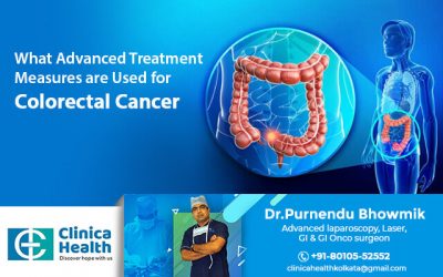 What Advanced Treatment Measures are Used for Colorectal Cancer.