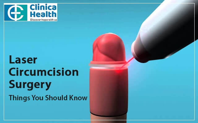 Things you should know before circumcision surgery