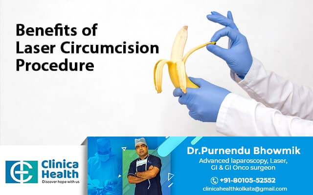 Benefits of Laser Circumcision Surgery
