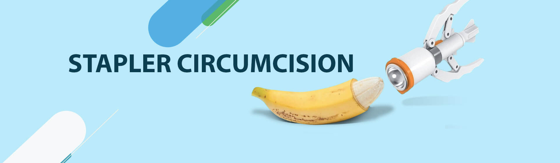 stapler circumcision 