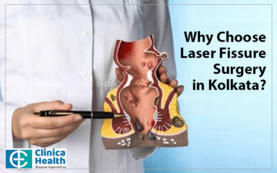 Why Choose Laser Fissure Surgery in Kolkata?
