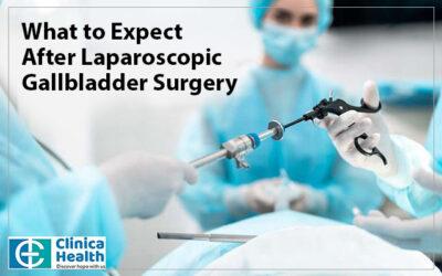 What to Expect After Laparoscopic Gallbladder Surgery