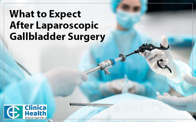 laparoscopic gallbladder surgeon
