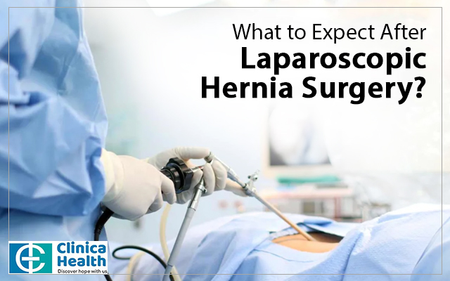 What to expect after Laparoscopic Hernia Surgery?