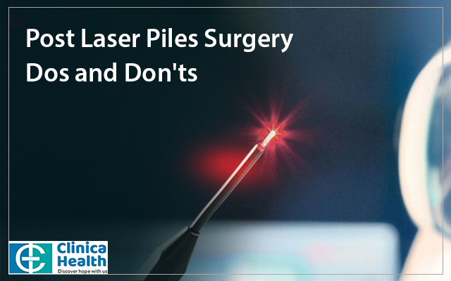 Post Laser Piles Surgery Dos and Don’ts