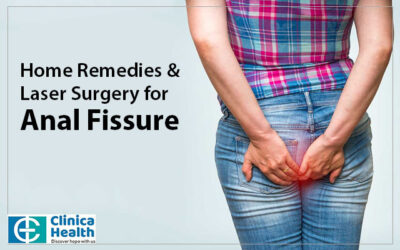 Home Remedies & Laser Surgery for Anal Fissure