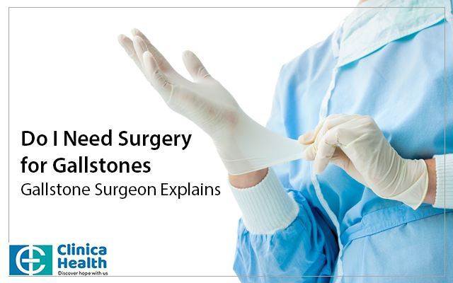Do I Need Surgery for Gallstones: Gallstone Surgeon Explains