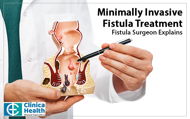 Minimally Invasive Fistula Treatment: Fistula Surgeon Explains