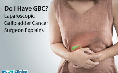 Do I Have GBC? Laparoscopic Gallbladder Cancer Surgeon Explains
