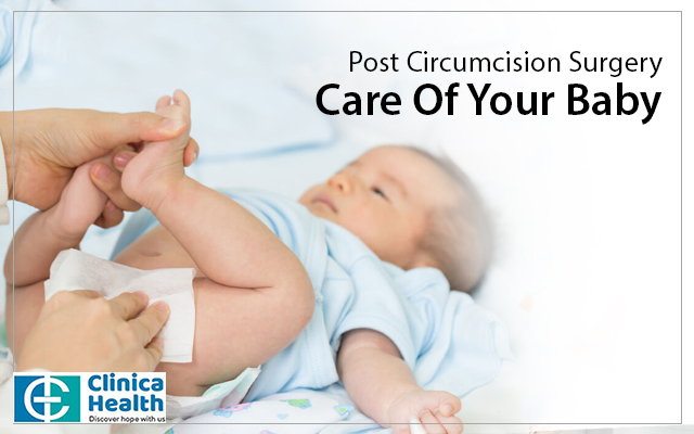 Post Circumcision Surgery Care Of Your Baby