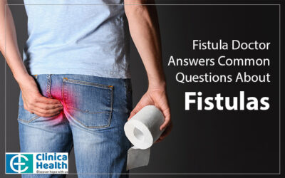 Fistula Doctor Answers Common Questions About Fistulas