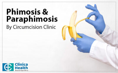 Phimosis & Paraphimosis – By Circumcision Clinic