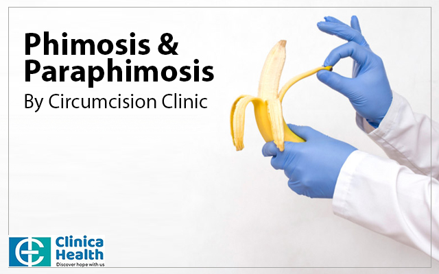 phimosis treatment in kolkata