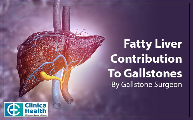 Fatty Liver’s Contribution To Gallstones-By Gallstone Surgeon
