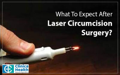What To Expect After Laser Circumcision Surgery?