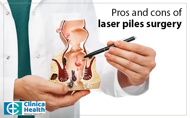 Pros and cons of laser piles surgery
