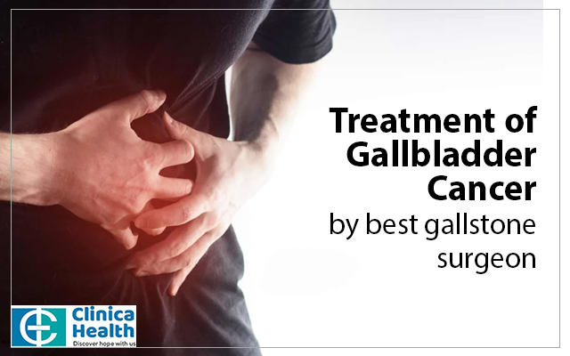 Treatment of Gallbladder Cancer by best gallstone surgeon