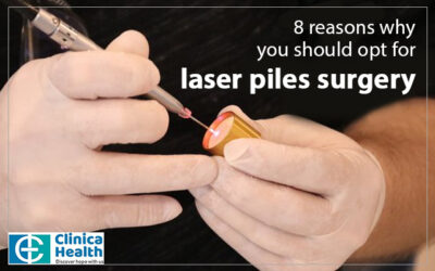 8 Reasons Why You Should Opt For Laser Piles Surgery
