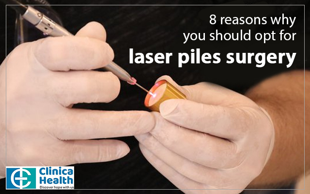 laser piles surgery