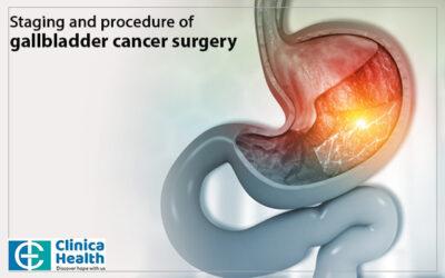 Staging and procedure of gallbladder cancer surgery