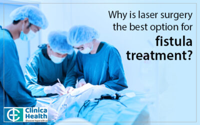 Why is laser surgery the best option for fistula treatment?