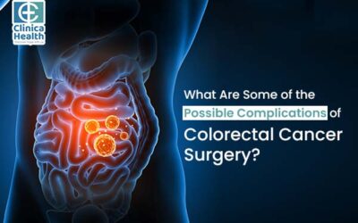 What Are Some of the Possible Complications of Colorectal Cancer Surgery?