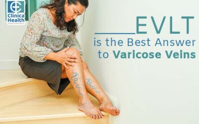 EVLT Is the Best Answer to Varicose Veins