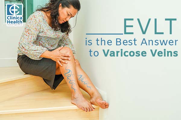 EVLT Is the Best Answer to Varicose Veins