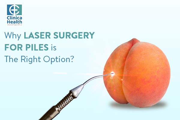 Why Laser Surgery for Piles Is The Right Option?