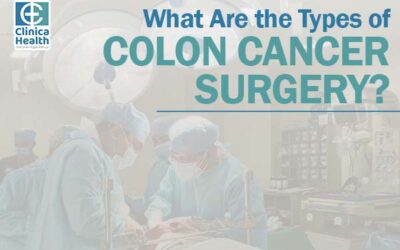What Are the Types of Colon Cancer Surgery?
