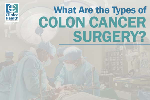 What Are the Types of Colon Cancer Surgery?