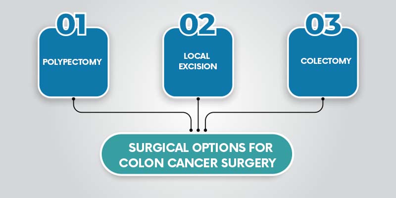 colon cancer surgery