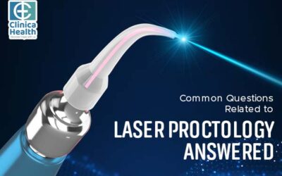 Common Questions Related to Laser Proctology Answered