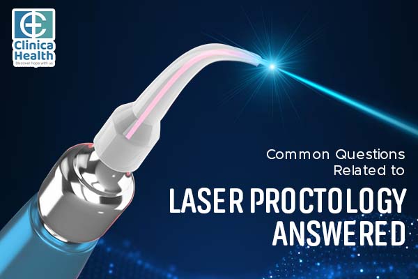 Common Questions Related to Laser Proctology Answered